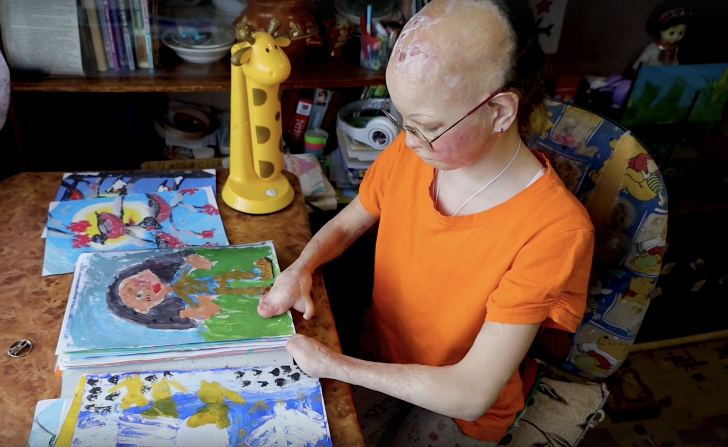 Жители Марий Эл могут осуществить мечту 11-летней девочки без кистей рук